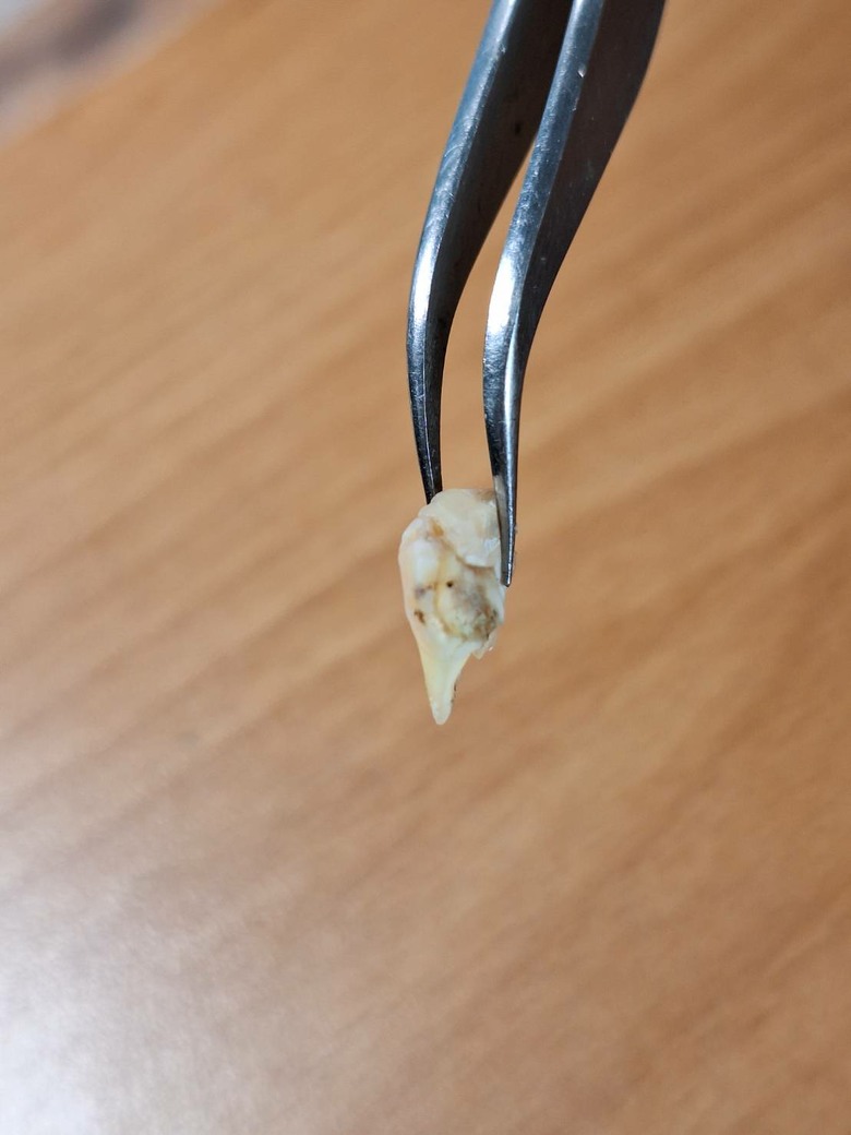 這顆牙還能留嗎(這是斷掉的部分)