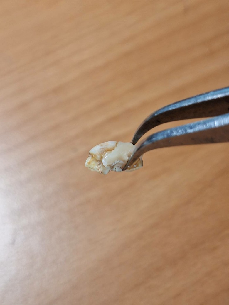 這顆牙還能留嗎(這是斷掉的部分)