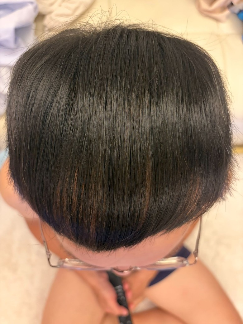 生髮帽效果比我想像中有感