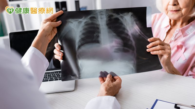 點我看大圖 破解肺癌偽裝身份!靠免疫四藥聯合有望取得長期存活效益