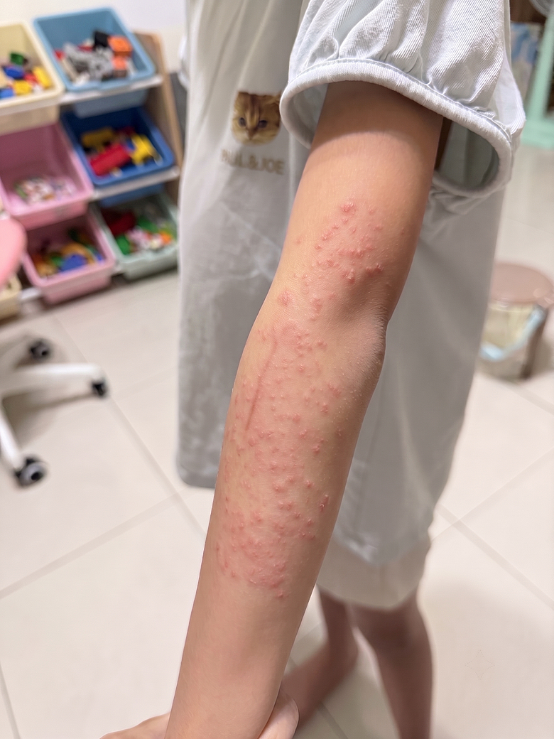 【分享】異位性皮膚炎寶寶的除氯對策：小陽台也能裝？建置成本與濾芯耗材花費大 PK