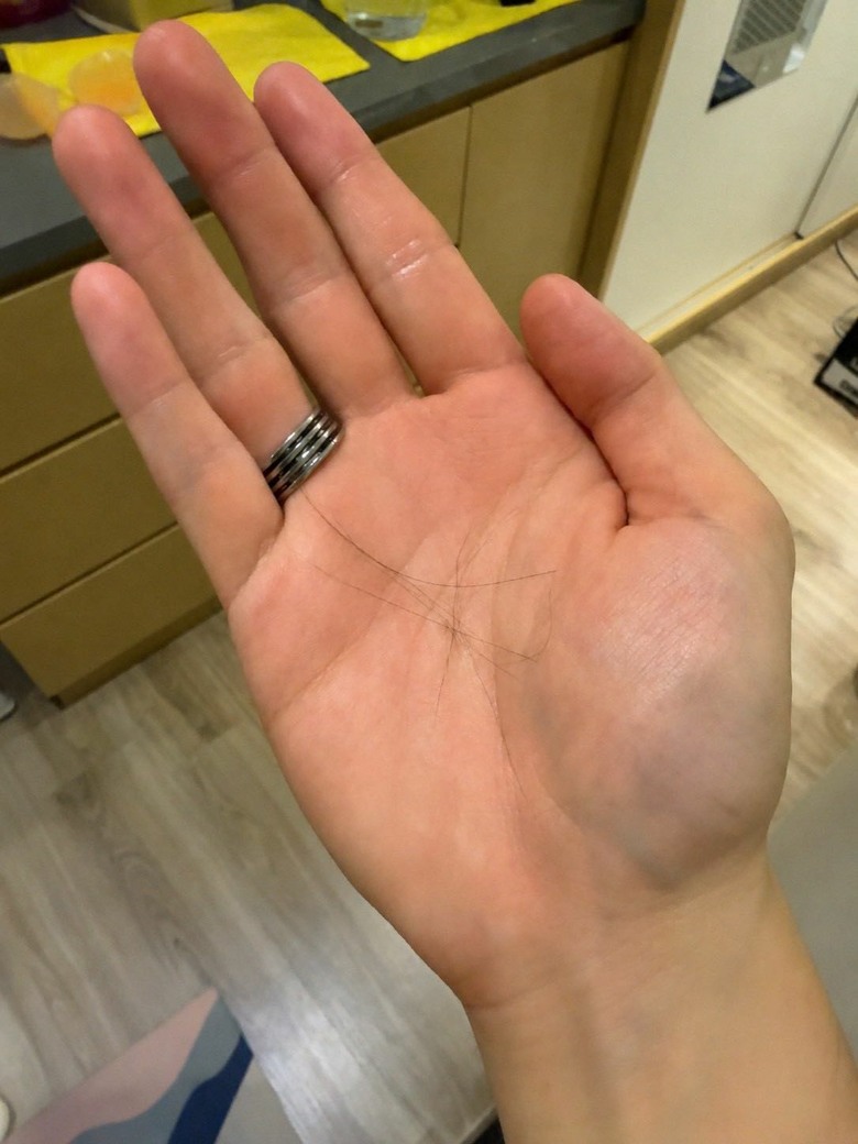 就問30歲為什麼會禿頭？