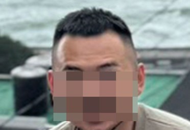 台北掉髮治療求推薦 打瘦瘦針瘦了10公斤，頭髮也跟著掉…Myhair有人去過嗎？