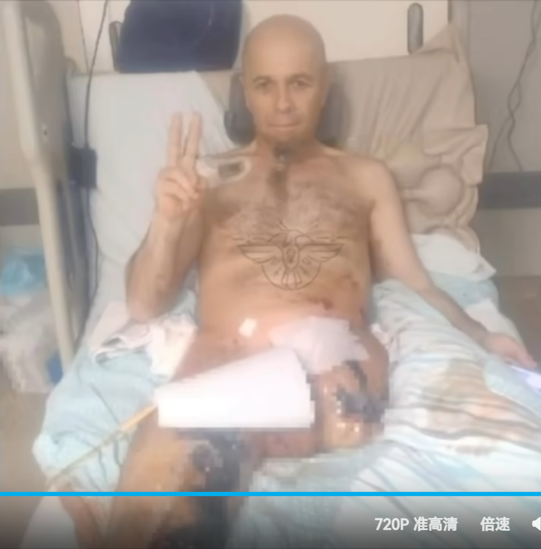 心寒！教召斷腿領嘸保險 1985：得死亡或半殘