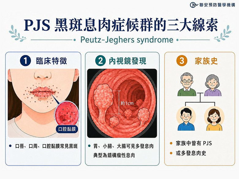 嘴唇黑斑洩露腸道危機？醫：從「面相」精準預警息肉，更驚藏乳癌高風險！